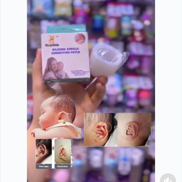 چسب اصلاح فرم گوش نوزاد مدل MK