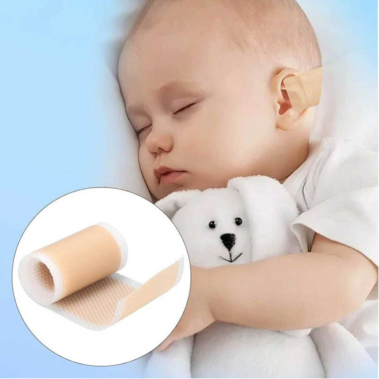 چسب اصلاح فرم گوش نوزاد مادرکر مدل 4/100