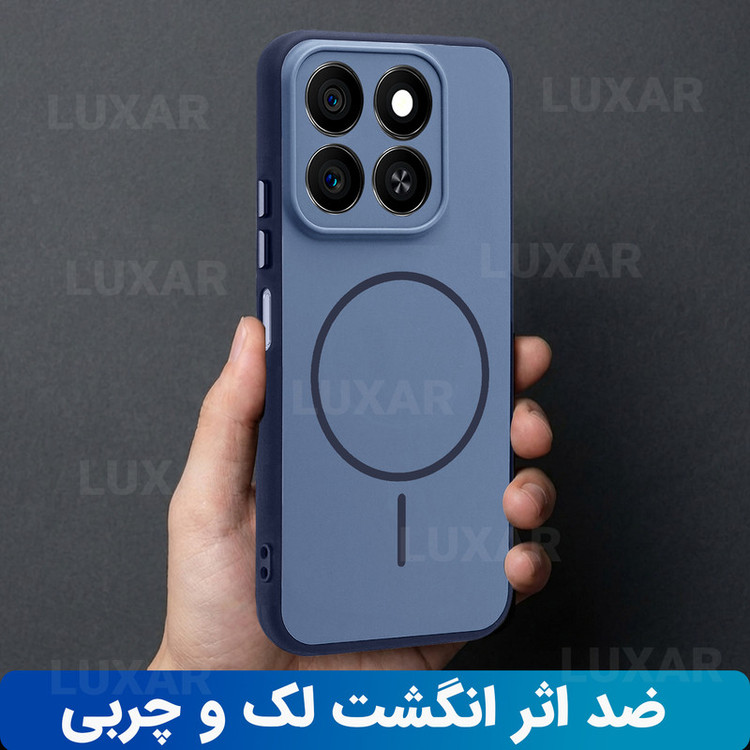 کاور لوکسار مدل x7c -Dora مناسب برای گوشی موبایل آنر Smart 200 / Play 60 Plus / X7C / Play 9T